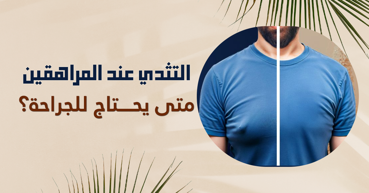 التثدي عند المراهقين