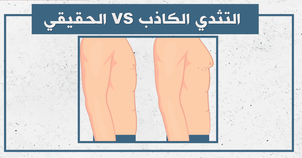 الفرق بين التثدي الكاذب والحقيقي