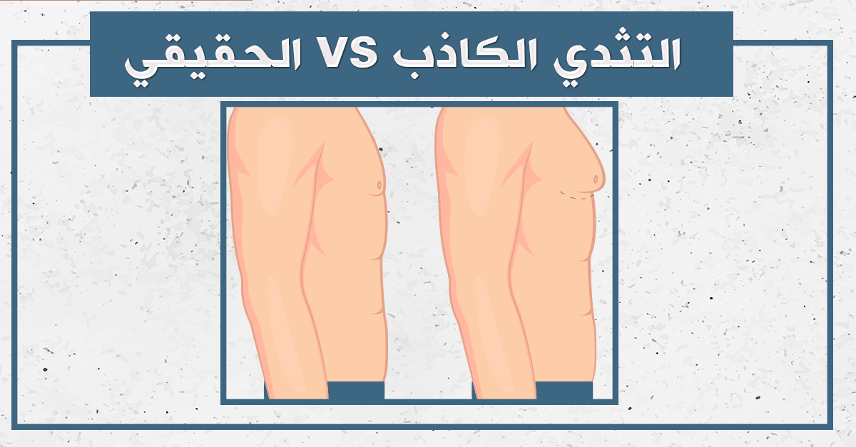الفرق بين التثدي الكاذب والحقيقي